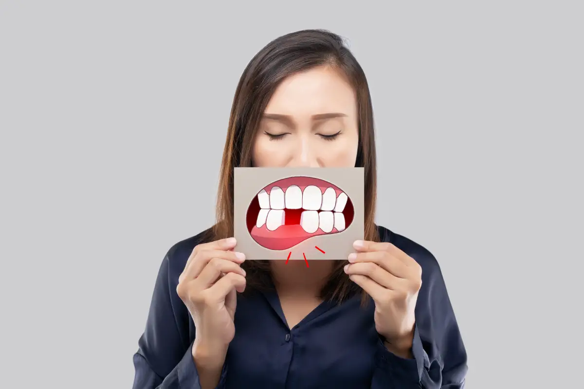 Dental Extraction Near Me | Top Care in Del Rey Oaks