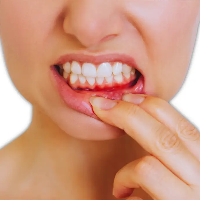 A woman with a gum swelling