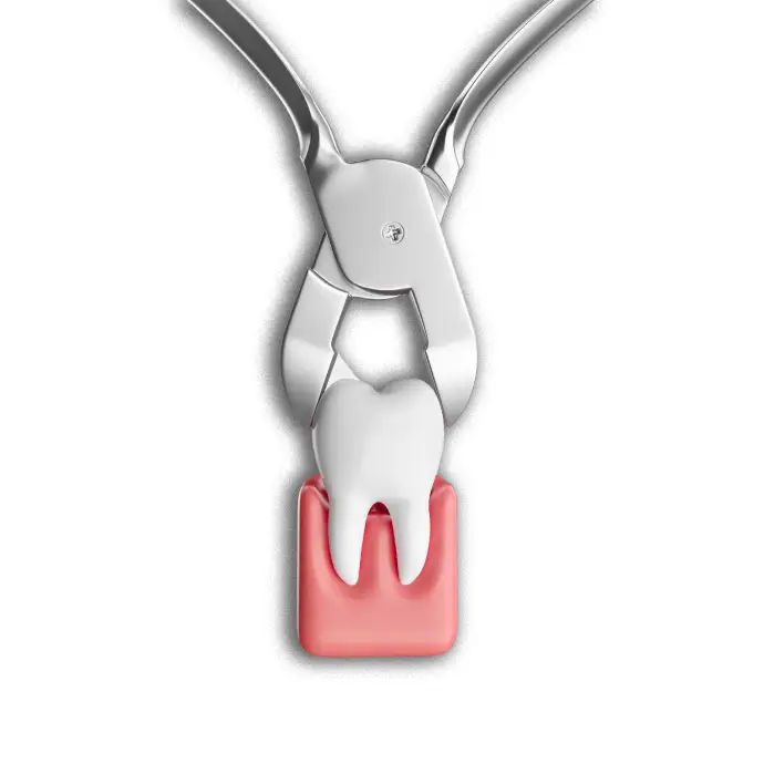 Dentist performing gentle tooth extraction procedure