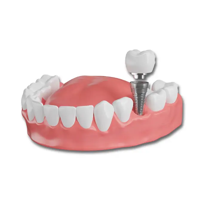 Person eating an apple confidently with dental implants