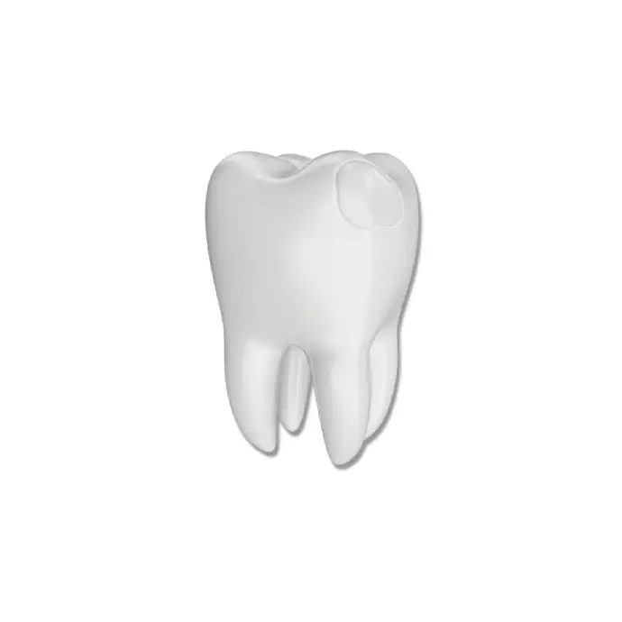 Dentist placing a white composite filling